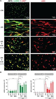 Itaconate Suppresses Formation of Neutrophil Extracellular Traps (NETs): Involvement of Hypoxia-Inducible Factor 1α (Hif-1α) and Heme Oxygenase (HO-1)